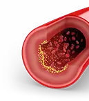 Cholesterol